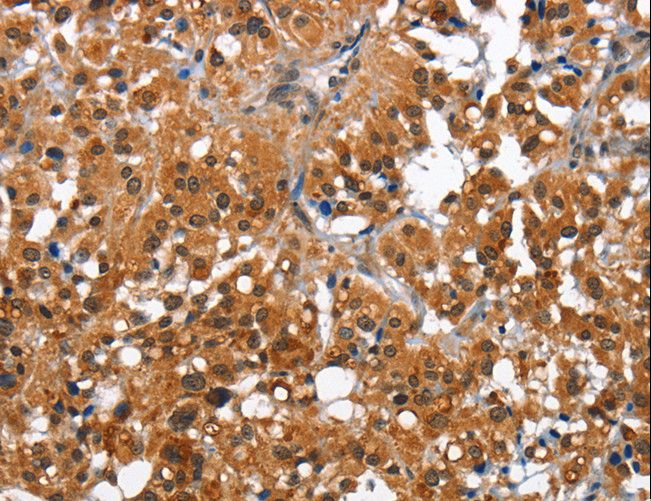 CAMK1D Antibody - Immunohistochemistry of paraffin-embedded Human brain using CAMK1D Polyclonal Antibody at dilution of 1:50.