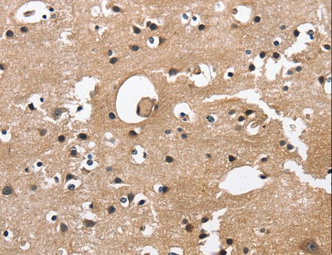 CAMK1D Antibody - Immunohistochemistry of paraffin-embedded Human brain using CAMK1D Polyclonal Antibody at dilution of 1:50.