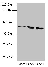 CAMK1D Antibody - Western blot All Lanes: CAMK1Dantibody at 2.9ug/ml Lane 1 : A549 whole cell lysate Lane 2 : 293T whole cell lysate Lane 3 : Jurkat whole cell lysate Secondary Goat polyclonal to Rabbit IgG at 1/10000 dilution Predicted band size: 43,41 kDa Observed band size: 43 kDa