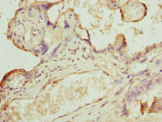 CAMK1D Antibody - Immunohistochemistry of paraffin-embedded human testis tissue at dilution 1:100