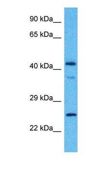 CAMK1D Antibody - Western blot of CAMK1D Antibody with human 721_B Whole Cell lysate.  This image was taken for the unconjugated form of this product. Other forms have not been tested.