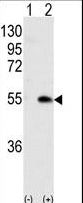 CAMK1G / CaMKI gamma Antibody - Western blot of CAMK1G (arrow) using rabbit polyclonal CAMK1G (Center K226) Antibody. 293 cell lysates (2 ug/lane) either nontransfected (Lane 1) or transiently transfected with CAMK1G gene (Lane 2) (Origene Technologies).