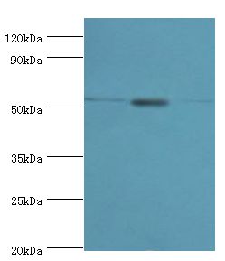 CAMK1G / CaMKI gamma Antibody - Western blot. All lanes: Calcium/calmodulin-dependent protein kinase type 1G antibody at 5 ug/ml. Lane 1: K562 whole cell lysate. Lane 2: HL-60 whole cell lysate. Lane 3: 293T whole cell lysate. secondary Goat polyclonal to rabbit at 1:10000 dilution. Predicted band size: 53 kDa. Observed band size: 53 kDa.