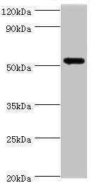 CAMK1G / CaMKI gamma Antibody - Western blot All lanes: CAMK1G antibody at 5µg/ml + HL60 whole cell lysate Secondary Goat polyclonal to rabbit IgG at 1/10000 dilution Predicted band size: 54, 52 kDa Observed band size: 54 kDa