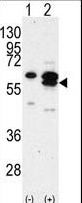 CAMK1G / CaMKI gamma Antibody - Western blot of CAMK1G (arrow) using rabbit polyclonal CAMK1G Antibody (RB01249). 293 cell lysates (2 ug/lane) either nontransfected (Lane 1) or transiently transfected with the CAMK1G gene (Lane 2) (Origene Technologies).
