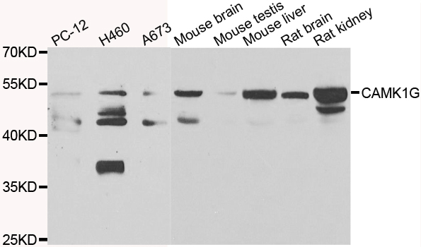 CAMK1G / CaMKI gamma Antibody - Western blot analysis of extracts of various cell lines.