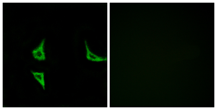 CAMK2 / CAMKII Antibody - Immunofluorescence analysis of COS7 cells, using CaMK2 (Phospho-Thr286) Antibody. The picture on the right is blocked with the phospho peptide.