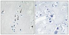 CAMK2 / CAMKII Antibody - Immunohistochemistry analysis of paraffin-embedded human brain, using CaMK2 (Phospho-Thr286) Antibody. The picture on the right is blocked with the phospho peptide.