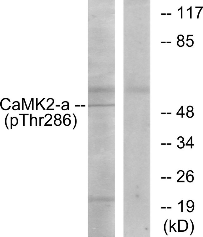 CAMK2 / CAMKII Antibody - Western blot analysis of lysates from K562 cells, using CaMK2 (Phospho-Thr286) Antibody. The lane on the right is blocked with the phospho peptide.