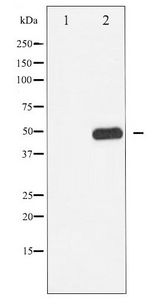 CAMK2 / CAMKII Antibody - Western blot of CaMK2 phosphorylation expression in K562 whole cell lysates,The lane on the left is treated with the antigen-specific peptide.