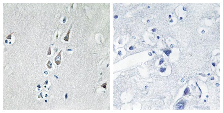 CAMK2 / CAMKII Antibody - P-peptide - + Immunohistochemistry analysis of paraffin-embedded human brain tissue using CaMK2 (Phospho-Thr286) antibody.