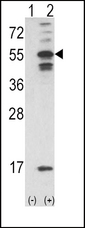CAMK2A / CaMKII Alpha Antibody - Western blot of CAMK2A (arrow) using rabbit polyclonal CAMK2A Antibody (C-term E370). 293 cell lysates (2 ug/lane) either nontransfected (Lane 1) or transiently transfected with the CAMK2A gene (Lane 2).