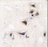 CAMK2A / CaMKII Alpha Antibody - Formalin-fixed and paraffin-embedded human brain tissue reacted with CAMK2 alpha Antibody , which was peroxidase-conjugated to the secondary antibody, followed by DAB staining. This data demonstrates the use of this antibody for immunohistochemistry; clinical relevance has not been evaluated.