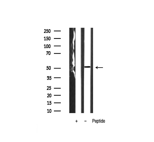 CAMK2A / CaMKII Alpha Antibody - Western blot analysis of CaMK2 alpha/beta/delta expression in NIH-3T3 whole cells lysates. The lane on the left is treated with the antigen-specific peptide.