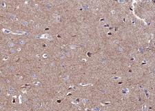 CAMK2A / CaMKII Alpha Antibody - 1:100 staining human brain tissue by IHC-P. The tissue was formaldehyde fixed and a heat mediated antigen retrieval step in citrate buffer was performed. The tissue was then blocked and incubated with the antibody for 1.5 hours at 22°C. An HRP conjugated goat anti-rabbit antibody was used as the secondary.