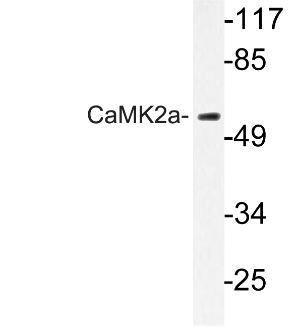 CAMK2A / CaMKII Alpha Antibody - Western blot of CaMK2-a (K292) pAb in extracts from A431 cells.