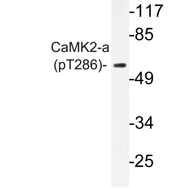 CAMK2A / CaMKII Alpha Antibody - Western blot of p-CaMK2-a (T286) pAb in extracts from A431 EGF cells.