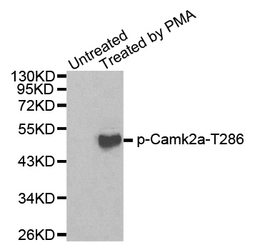 CAMK2A / CaMKII Alpha Antibody - Western blot analysis of extracts from 293 cells.