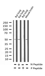 CAMK2A / CaMKII Alpha Antibody - Western blot analysis of Phospho-CaMK2 (Thr286) expression in various lysates