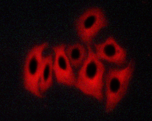 CAMK2A / CaMKII Alpha Antibody - Staining MKN-45 cells treated with Forskolin 30 µM, 20 min by IF/ICC. The samples were fixed with PFA and permeabilized in 0.1% saponin prior to blocking in 10% serum for 45 min at 37°C. The primary antibody was diluted 1/400 and incubated with the sample for 1 hour at 37°C. A Alexa Fluor 594 conjugated goat polyclonal to rabbit IgG (H+L), diluted 1/600 was used as secondary antibody.