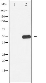 CAMK2A / CaMKII Alpha Antibody - Western blot analysis of CaMK2 phosphorylation expression in K562 whole cells lysates. The lane on the left is treated with the antigen-specific peptide.