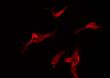 CAMK2A / CaMKII Alpha Antibody - Staining NIH-3T3 cells by IF/ICC. The samples were fixed with PFA and permeabilized in 0.1% Triton X-100, then blocked in 10% serum for 45 min at 25°C. The primary antibody was diluted at 1:200 and incubated with the sample for 1 hour at 37°C. An Alexa Fluor 594 conjugated goat anti-rabbit IgG (H+L) Ab, diluted at 1/600, was used as the secondary antibody.