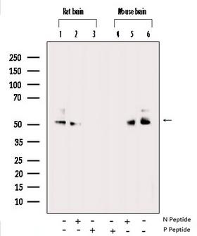 CAMK2A / CaMKII Alpha Antibody - Western blot analysis of Phospho-CaMK2 alpha/beta/delta (Thr305) expression in various lysates