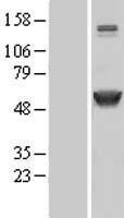 CAMK2A / CaMKII Alpha Protein - Western validation with an anti-DDK antibody * L: Control HEK293 lysate R: Over-expression lysate