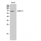 CAMK2B / CaMKII Beta Antibody - Western blot of CaMKIIbeta antibody