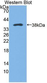 CAMK2B / CaMKII Beta Antibody - Western blot of CAMK2B / CaMKII Beta antibody.