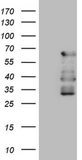 CAMK2B / CaMKII Beta Antibody - HEK293T cells were transfected with the pCMV6-ENTRY control (Left lane) or pCMV6-ENTRY CAMK2B (Right lane) cDNA for 48 hrs and lysed. Equivalent amounts of cell lysates (5 ug per lane) were separated by SDS-PAGE and immunoblotted with anti-CAMK2B (1:2000).