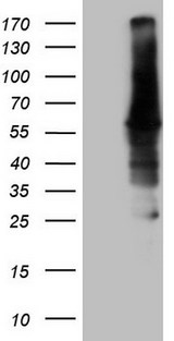 CAMK2B / CaMKII Beta Antibody - HEK293T cells were transfected with the pCMV6-ENTRY control. (Left lane) or pCMV6-ENTRY CAMK2B. (Right lane) cDNA for 48 hrs and lysed. Equivalent amounts of cell lysates. (5 ug per lane) were separated by SDS-PAGE and immunoblotted with anti-CAMK2B. (1:2000)