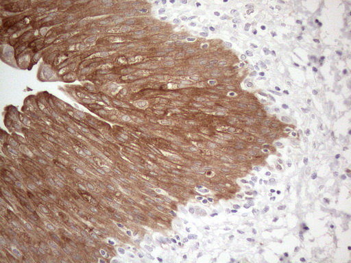 CAMK2B / CaMKII Beta Antibody - Immunohistochemical staining of paraffin-embedded Human bladder tissue within the normal limits using anti-CAMK2B mouse monoclonal antibody. (Heat-induced epitope retrieval by 1mM EDTA in 10mM Tris buffer. (pH8.5) at 120°C for 3 min. (1:150)