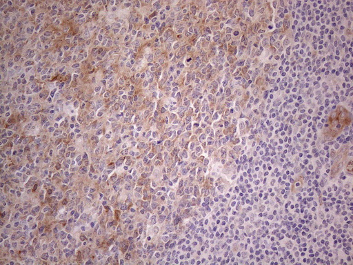 CAMK2B / CaMKII Beta Antibody - Immunohistochemical staining of paraffin-embedded Human tonsil within the normal limits using anti-CAMK2B mouse monoclonal antibody. (Heat-induced epitope retrieval by 1mM EDTA in 10mM Tris buffer. (pH8.5) at 120°C for 3 min. (1:150)