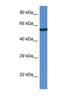 CAMK2B / CaMKII Beta Antibody - CAMK2B antibody Western blot of 1 Cell lysate. Antibody concentration 1 ug/ml.  This image was taken for the unconjugated form of this product. Other forms have not been tested.