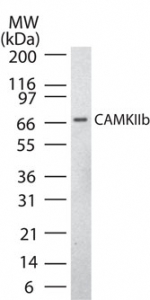 CAMK2B / CaMKII Beta Antibody - Western blot of CAMKIIb in rat brain lysate using antibody at1:2000.