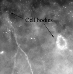 CAMK2B / CaMKII Beta Antibody - Immunofluorescent staining of CAMKIIb using antibody in rat hippocampal neurons at a dilution of 1:100, note that staining is rather weak.