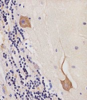 CAMK2B / CaMKII Beta Antibody - CAMK2 beta Antibody (C-term) staining CAMK2 in human cerebellum tissue sections by Immunohistochemistry (IHC-P - paraformaldehyde-fixed, paraffin-embedded sections). Tissue was fixed with formaldehyde and blocked with 3% BSA for 0. 5 hour at room temperature; antigen retrieval was by heat mediation with a citrate buffer (pH6). Samples were incubated with primary antibody (1/25) for 1 hours at 37°C. A undiluted biotinylated goat polyvalent antibody was used as the secondary antibody.