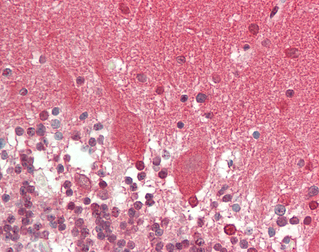 CAMK2B / CaMKII Beta Antibody - Human Brain, Cerebellum: Formalin-Fixed, Paraffin-Embedded (FFPE).  This image was taken for the unconjugated form of this product. Other forms have not been tested.