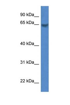 CAMK2B / CaMKII Beta Antibody - CAMK2B antibody Western blot of Fetal Heart lysate. Antibody concentration 1 ug/ml.  This image was taken for the unconjugated form of this product. Other forms have not been tested.