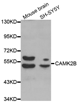 CAMK2B / CaMKII Beta Antibody - Western blot analysis of extracts of various cell lines.