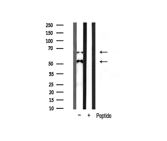 CAMK2B / CaMKII Beta Antibody - Western blot analysis of CaMK2-beta/gamma/delta expression in rat spleen tissue lysates. The lane on the right is treated with the antigen-specific peptide.