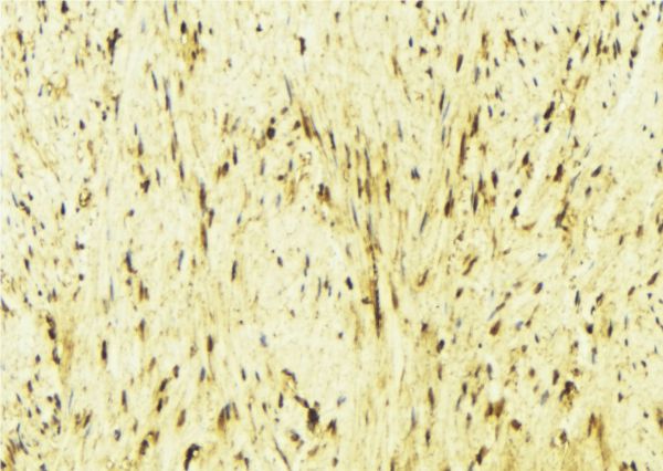CAMK2B / CaMKII Beta Antibody - 1:100 staining mouse muscle tissue by IHC-P. The sample was formaldehyde fixed and a heat mediated antigen retrieval step in citrate buffer was performed. The sample was then blocked and incubated with the antibody for 1.5 hours at 22°C. An HRP conjugated goat anti-rabbit antibody was used as the secondary.