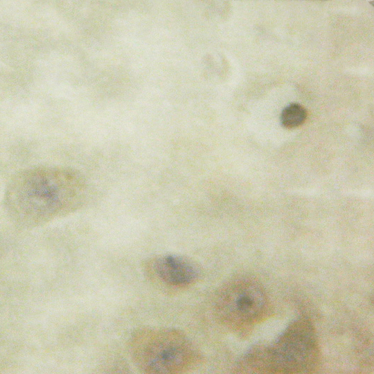 CAMK2B / CaMKII Beta Antibody - 1/100 staining human brain tissue by IHC-P. The sample was formaldehyde fixed and a heat mediated antigen retrieval step in citrate buffer was performed. The sample was then blocked and incubated with the antibody for 1.5 hours at 22°C. An HRP conjugated goat anti-rabbit antibody was used as the secondary antibody.
