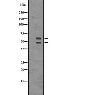 CAMK2B / CaMKII Beta Antibody - Western blot analysis of CaMKII using COLO205 whole cells lysates