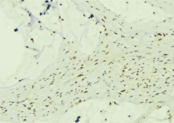 CAMK2B / CaMKII Beta Antibody - 1:100 staining mouse muscle tissue by IHC-P. The sample was formaldehyde fixed and a heat mediated antigen retrieval step in citrate buffer was performed. The sample was then blocked and incubated with the antibody for 1.5 hours at 22°C. An HRP conjugated goat anti-rabbit antibody was used as the secondary.