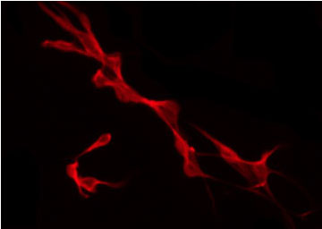CAMK2B / CaMKII Beta Antibody - Staining U87 cells by IF/ICC. The samples were fixed with PFA and permeabilized in 0.1% Triton X-100, then blocked in 10% serum for 45 min at 25°C. The primary antibody was diluted at 1:200 and incubated with the sample for 1 hour at 37°C. An Alexa Fluor 594 conjugated goat anti-rabbit IgG (H+L) Ab, diluted at 1/600, was used as the secondary antibody.