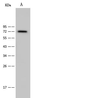 CAMK2B / CaMKII Beta Antibody - Lane A: MOLT4 Whole Cell Lysate. Lysates/proteins at 30 ug per lane. Secondary: Goat Anti-Rabbit IgG (H+L)/HRP at 1/10000 dilution. Developed using the ECL technique. Performed under reducing conditions. Predicted band size: 72 kDa. Observed band size: 72 kDa.