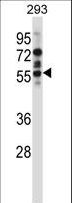 CAMK2D / CaMKII Delta Antibody - Mouse Camk2d Antibody western blot of 293 cell line lysates (35 ug/lane). The Camk2d antibody detected the Camk2d protein (arrow).