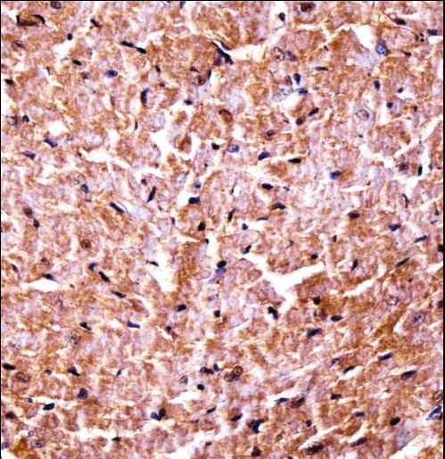 CAMK2D / CaMKII Delta Antibody - Mouse Camk2d Antibody immunohistochemistry of formalin-fixed and paraffin-embedded mouse heart tissue followed by peroxidase-conjugated secondary antibody and DAB staining.